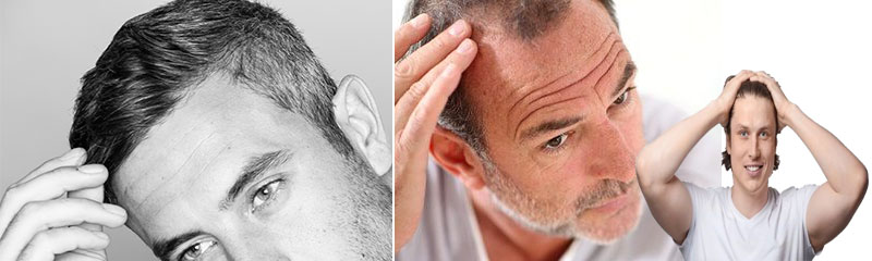 Vital Tips on How to Find a Reliable Hair Restoration Clinic