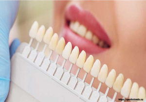 Cosmetic Dentistry Is Able to Install New Confidence and Raise Self-Esteem