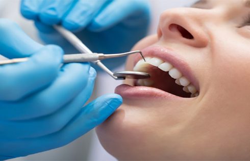 5 Tips to Choose a Perfect Dental Treatment
