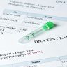 Cases in Which You May Require a Legal Paternity Test